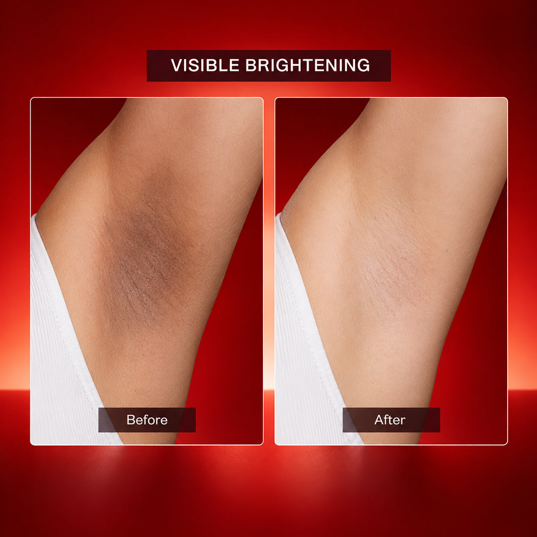 Whitening Cream